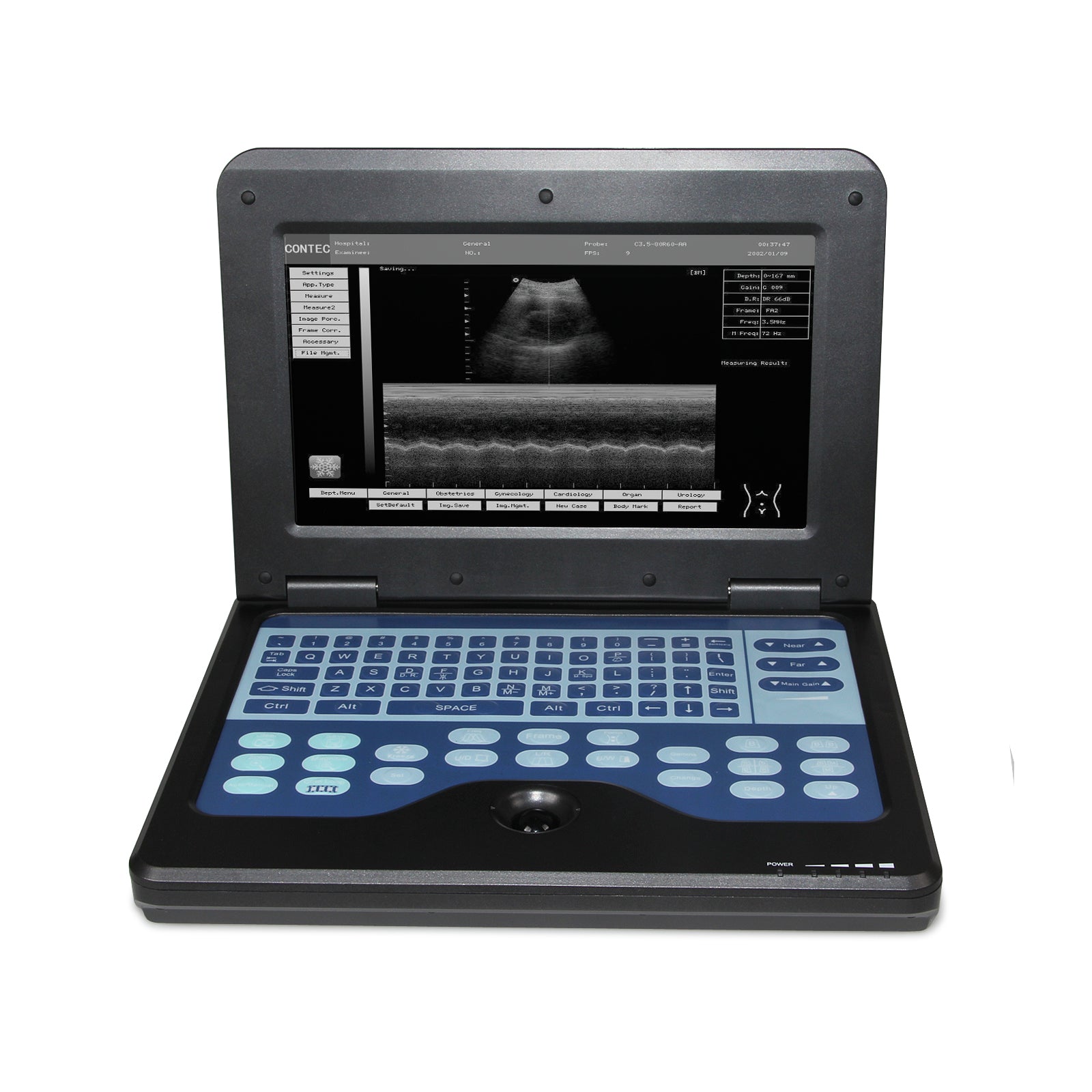 FINE LINE DIGITAL ULTRASOUND SCANNER - FINE LINE QUALITY PRODUCTS