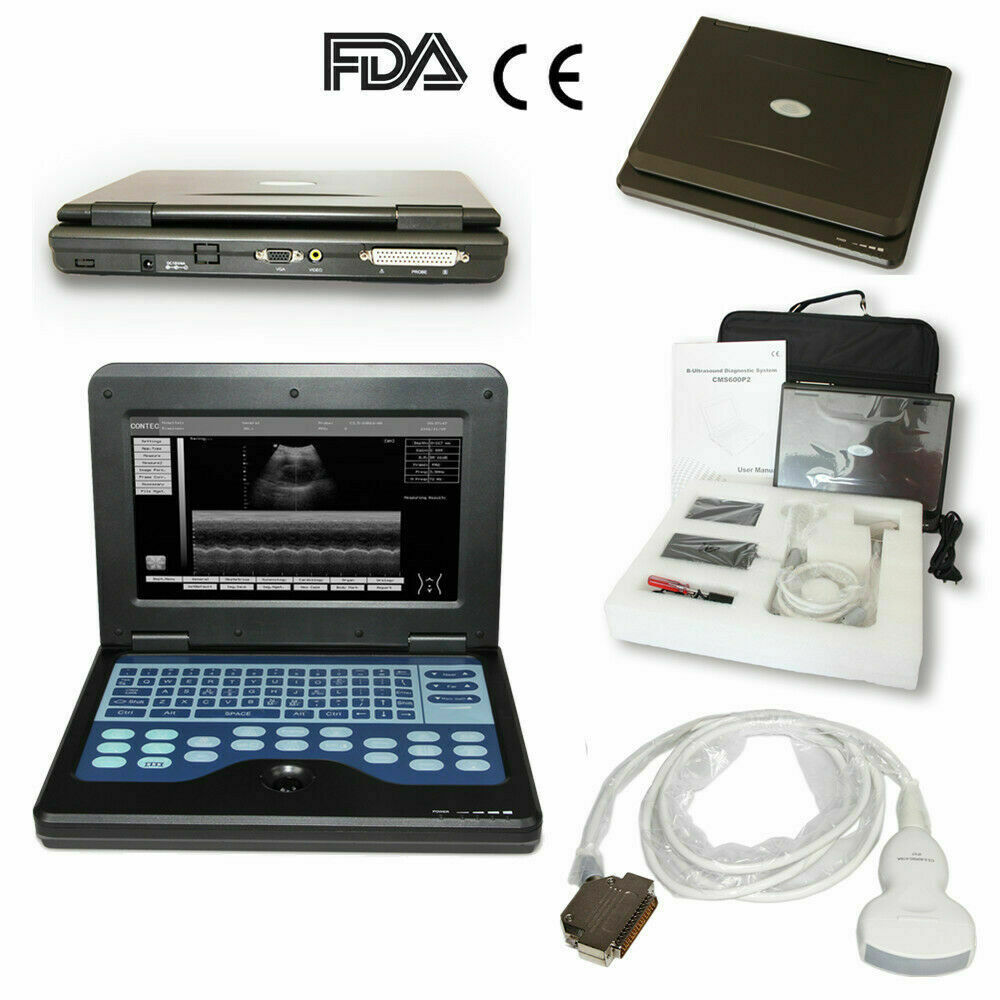 FINE LINE DIGITAL ULTRASOUND SCANNER - FINE LINE QUALITY PRODUCTS