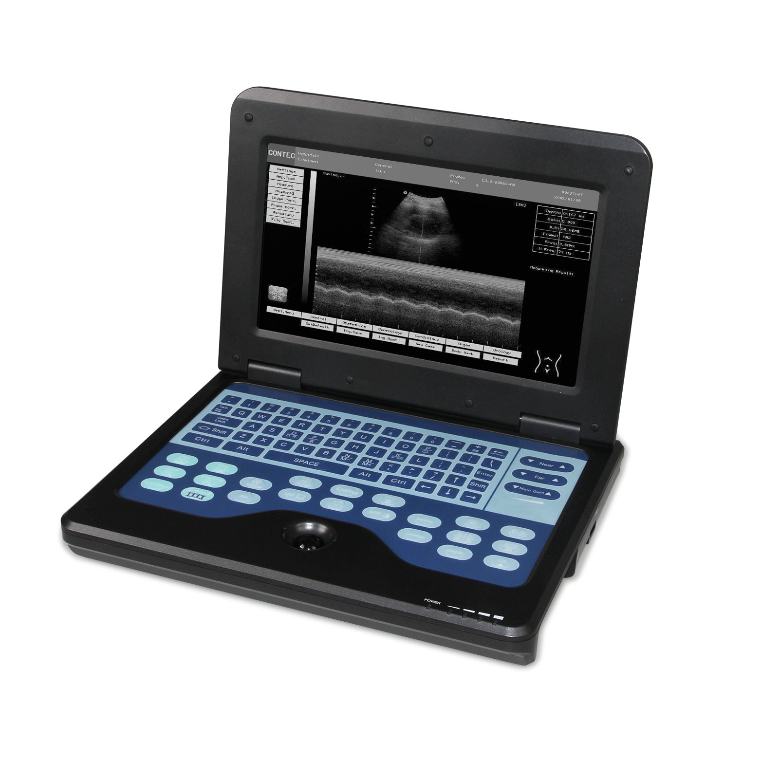 FINE LINE DIGITAL ULTRASOUND SCANNER - FINE LINE QUALITY PRODUCTS